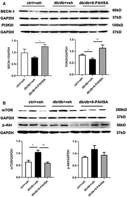 9-PAHSA Improves Cardiovascular Complications by Promoting Autophagic Flux and Reducing Myocardial Hypertrophy in Db/Db Mice